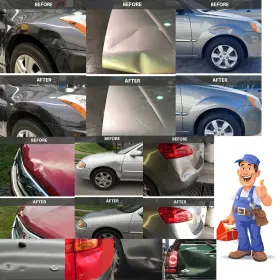 Autopdr 736081841484 Paintless Dent Repair Kits 100pcs Car Removal Tools Come With 4 #3