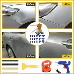 Zs9070162 Auxito 32 Pcs Dent Paintless Car Puller Repair Kit Remover Lifter Dint Hail Damage Tool