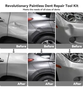 Tools 696576968938 Dent Puller Hail Remover Kits Professional Car Paintless Removal #2